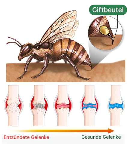 Neuseeland Bienenstich Gelenk-Bienenstich Schmerz- und Knochenheilungscreme