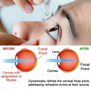 Optilize™ Eye Care Drops