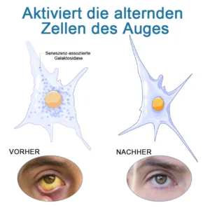 Ourlyard™ Augentropfen zur Behandlung von Sehproblemen