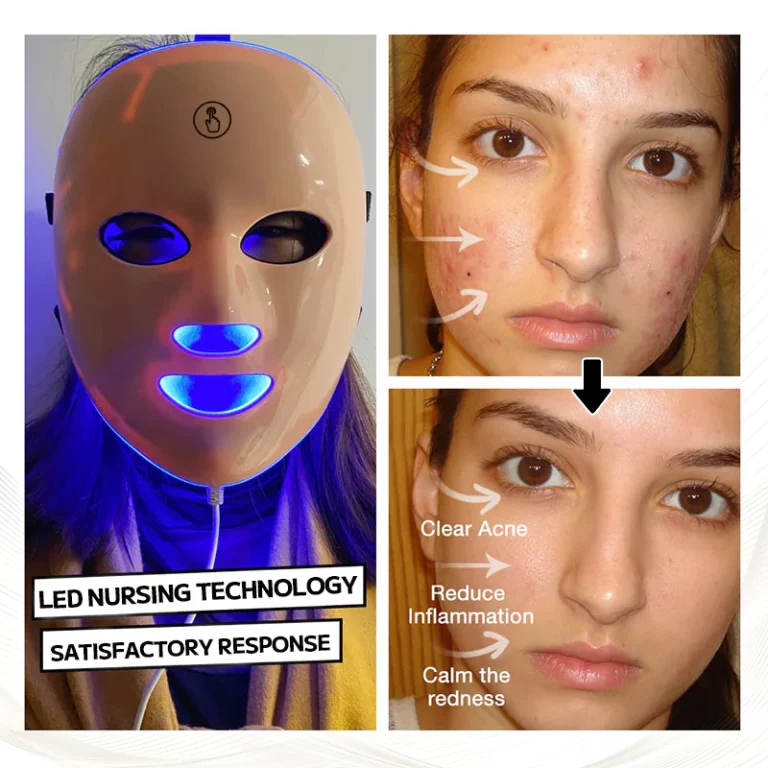 Ourlyard™ Laser Treatment Facial Mask for Rosacea