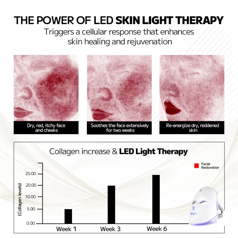 Ourlyard™ Laser Treatment Facial Mask for Rosacea