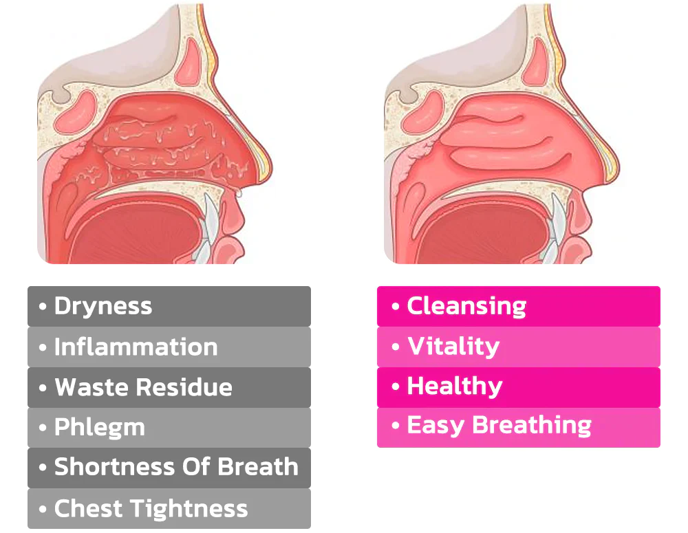 Oveallgo™ BreathePure Nasal Mucus Clearing Clip