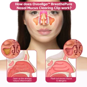 Oveallgo™ BreathePure Nasal Mucus Clearing Clip