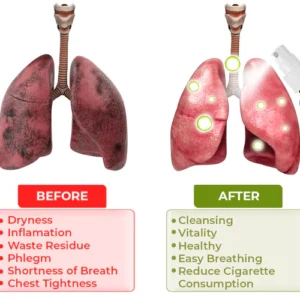 Oveallgo™ Herbal Spray for Lung and Respiratory Support