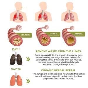 Oveallgo™ Herbal Spray for Lung and Respiratory Support