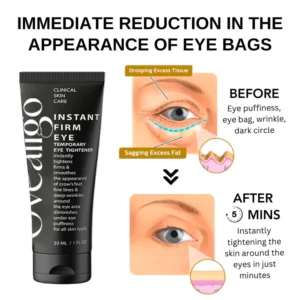 Oveallgo™ Clinical SkinCare Instant Eye Tightener