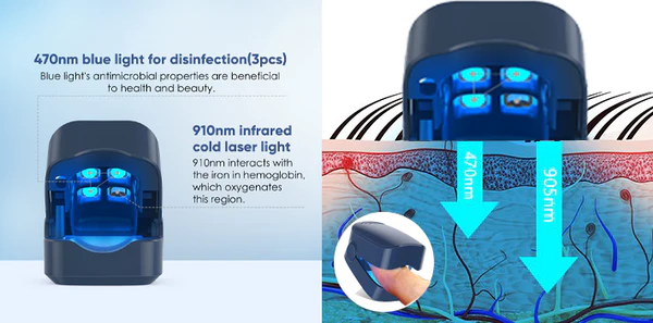 Oveallgo™ Expert Revolutionary High-Efficiency Light Therapy Device For Toenail Diseases