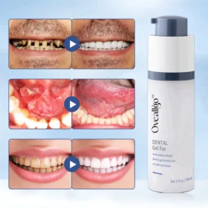 Oveallgo™ Gel dental blanqueador reparador regenerador de dientes