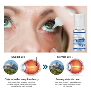 Oveallgo™ Myopia Reversal Eye Drops