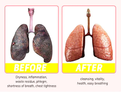 Oveallgo™ RespireWell Herbal Spray for Lung and Respiratory Support