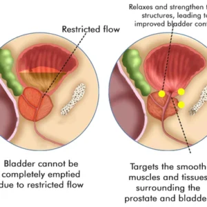 REVIVI™ Advanced Prostate Therapy Drops