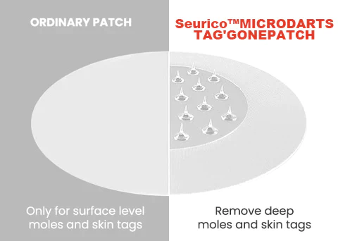 Seurico™ MicroDarts TAG'Gone Patch