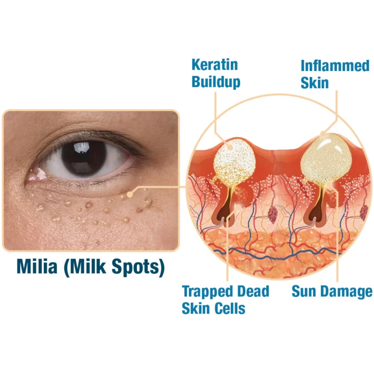 flysmus™ CaviarLuxe Far Infrared Radiance Milk Spot Cream