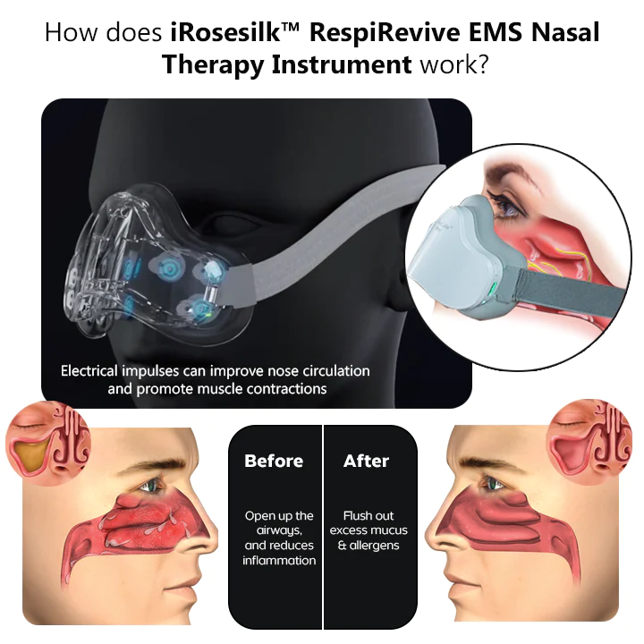 iRosesilk™ RespiRevive EMS Nasal Therapy Instrument