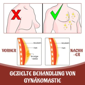 Biancat™ SleekChest Gynäkomastie Cellulite Schmelz-Pflaster