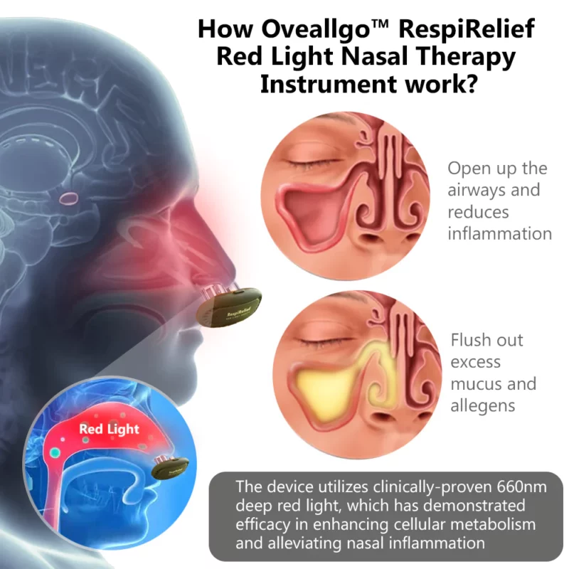 Oveallgo™ ProX RespiRelief Red Light Nasal Therapy Instrument
