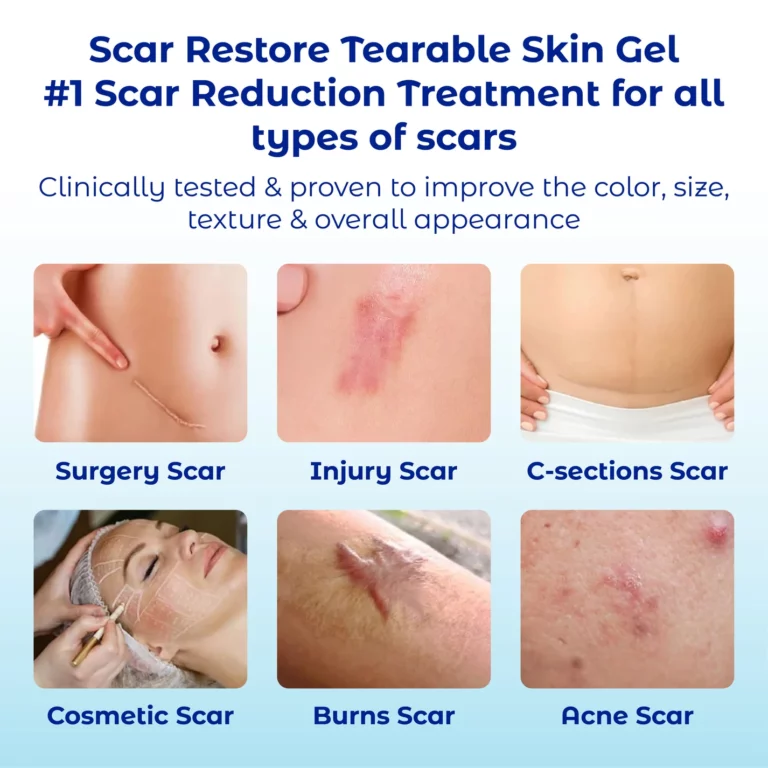 ATTDX ScarRestore Tearable Skin Gel