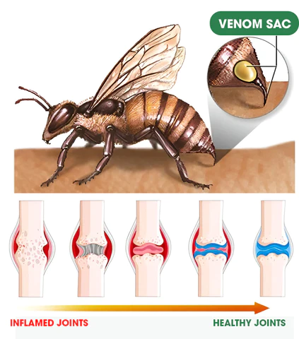 Aeehfeng™ Bee Venom Joint Therapy Pain Relief Gel