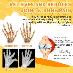 Aeehfeng™ Bee Venom Joint Therapy Pain Relief Gel