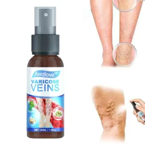 Awzlove™ Varicose Veins Spray