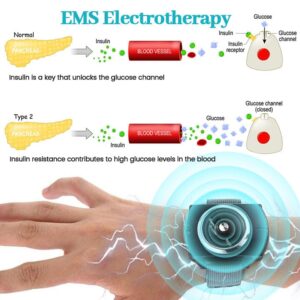 Biancat™ GylcoNova Electric Pulse Device