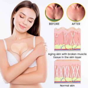 Biancat™ RevitaShape Breast Smoothin Patches