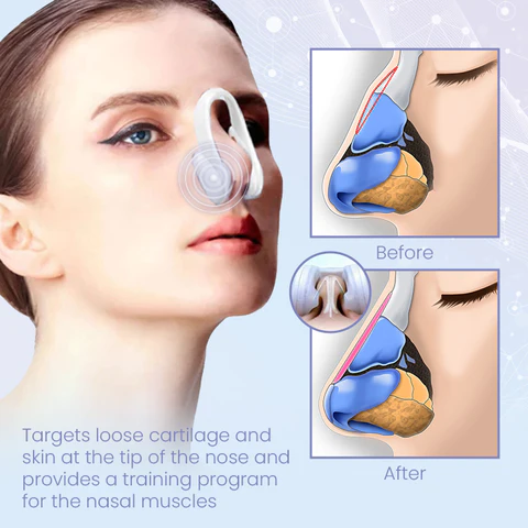 Ceoerty™ Sculptify Nose Enhancer Device