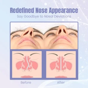 Ceoerty™ Sculptify Nose Enhancer Device