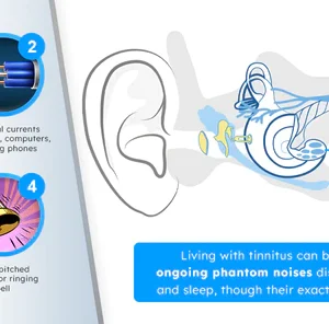 Dafeila™ SoniClip Tinnitus Relief Device