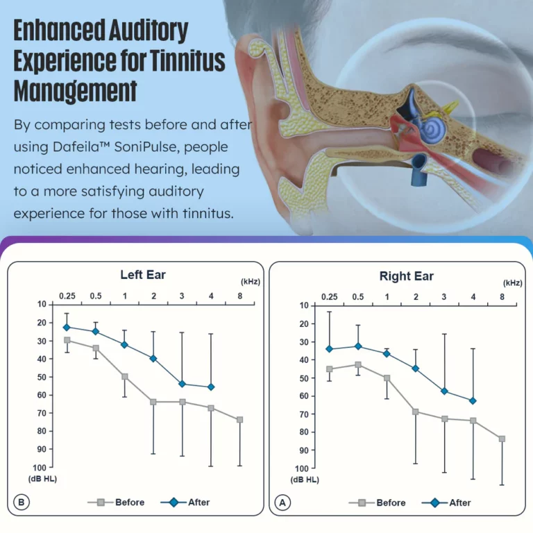 Dafeila™ SoniPulse Tinnitus Relief Soothing Aid