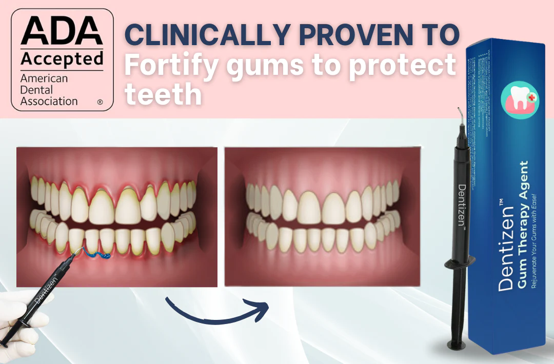 Dentizen™ Gum Therapy Agent