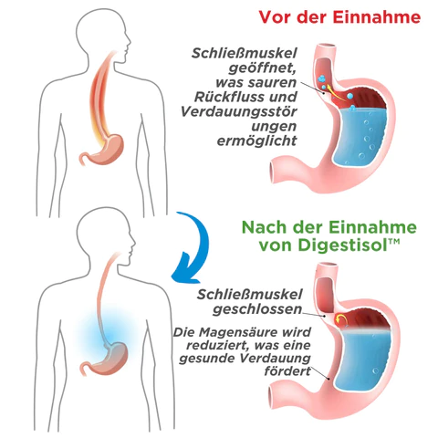 Digestisol™ Tropfen für Verdauungsstörungen