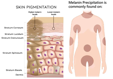 Dobshow™ Acanthosis Nigricans Hyperpigmentation Therapy Cream