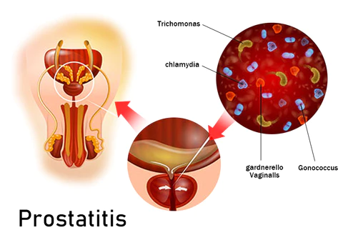 Dobshow™ Prostate Health Herbal Capsules