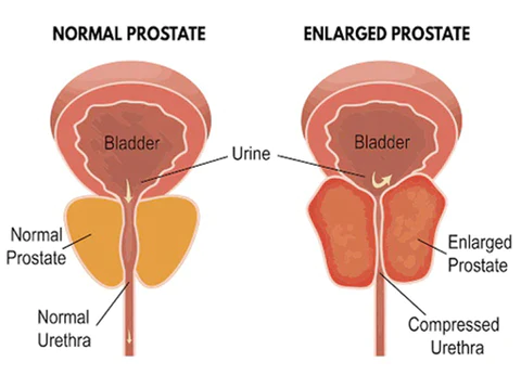 Dobshow™ Prostate Health Herbal Capsules