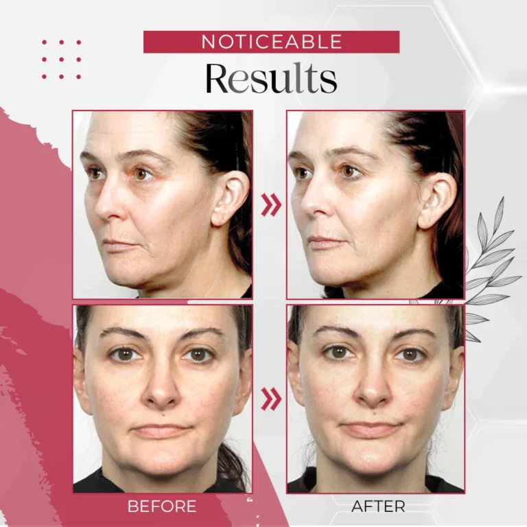 Firming Powerful V-Shape Face Care