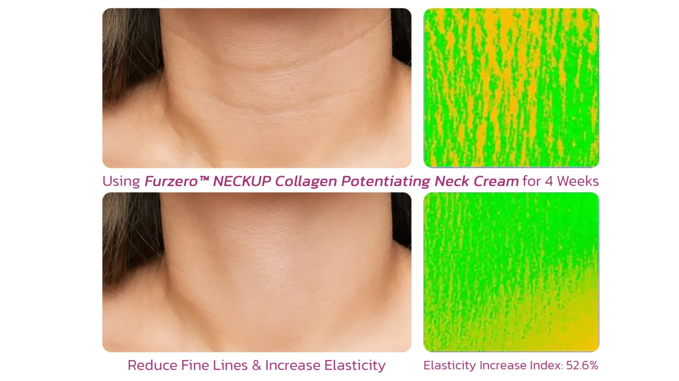 Furzero™ NECKUP Collagen Potentiating Neck Cream