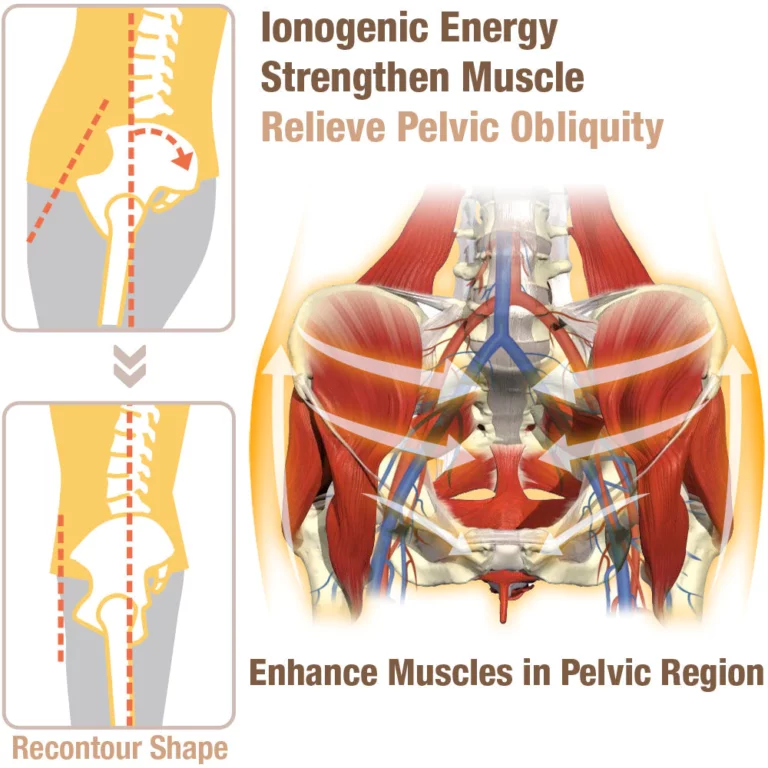 GFOUK™ PelvicFlex Ionogenic Fabric Shaper