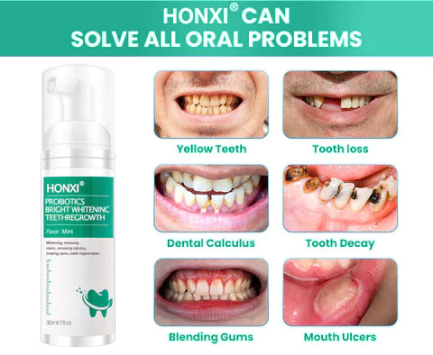 HONXI™ Herbal Brightening Oral Repair Foam