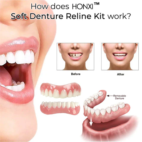 HONXI™ Reline soft denture kit