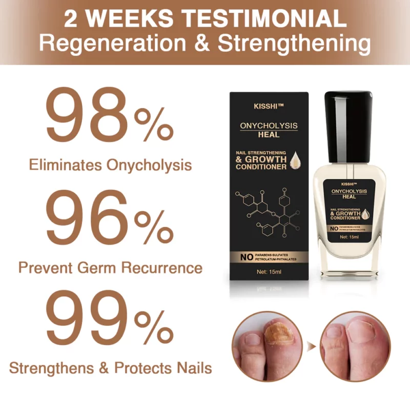 Kisshi™ OnycholysisHeal Nail Strengthening And Growth Conditioner