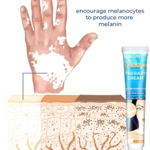 MelFix™ Vitiligo Therapy Cream