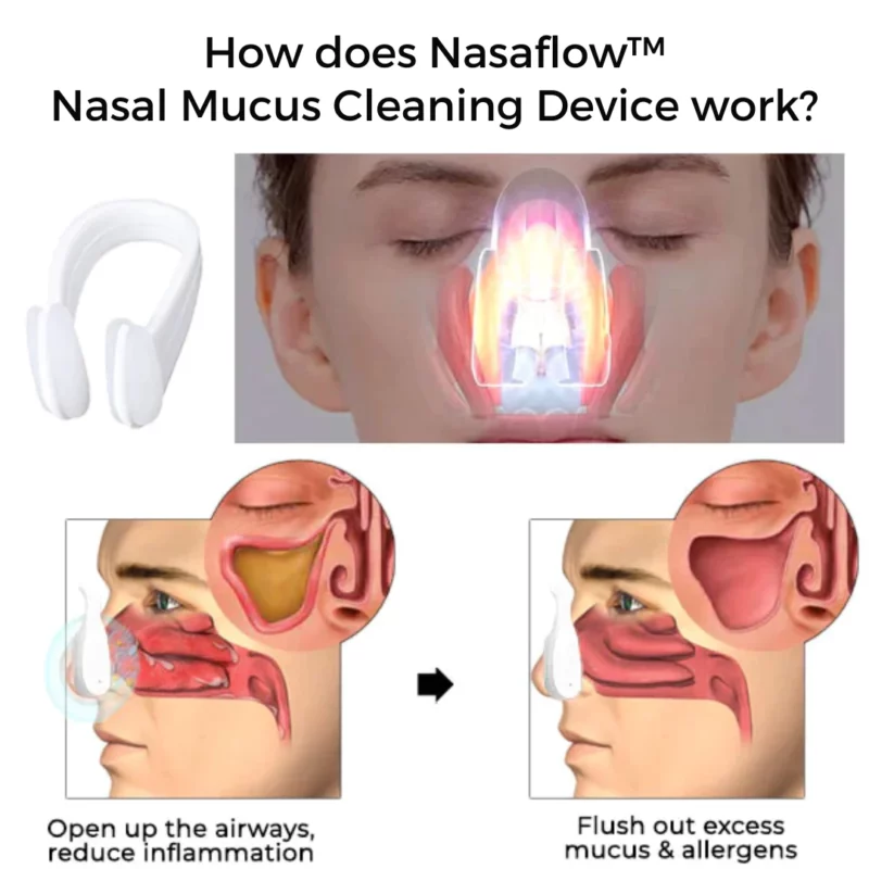 Nasaflow™ Nasal Mucus Cleaning Device