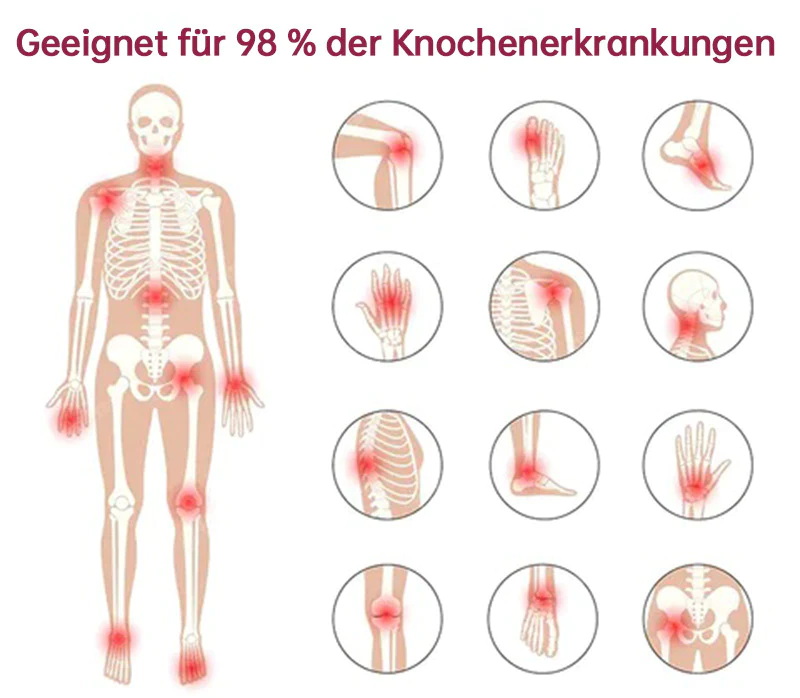 Ourlyard™ Neuseeland Bienengift Gelenk- und Knochen-Therapie Fortgeschrittene Creme