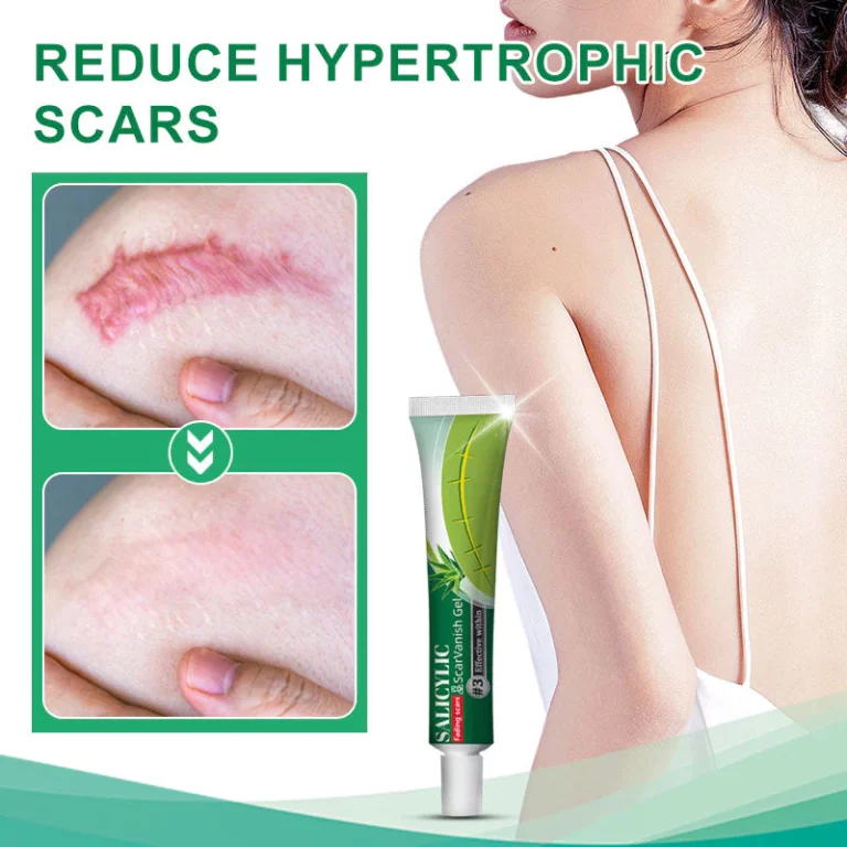 Ourlyard™ Salicylic Acid Scar Removal Gel