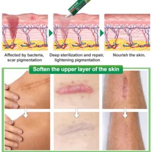 Ourlyard™ Salicylic Acid Scar Removal Gel