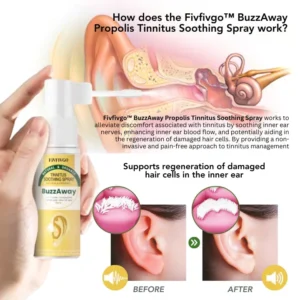 Oveallgo™ BuzzAway Propolis Tinnitus Soothing Spray