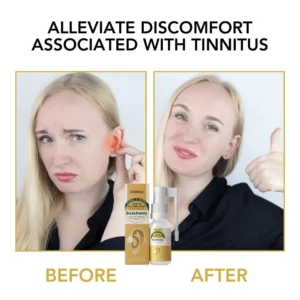 Oveallgo™ BuzzAway Propolis Tinnitus Soothing Spray