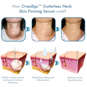 Oveallgo™ Goiterless Neck Skin Firming Serum