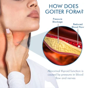 Oveallgo™ Goiterless Neck Skin Firming Serum